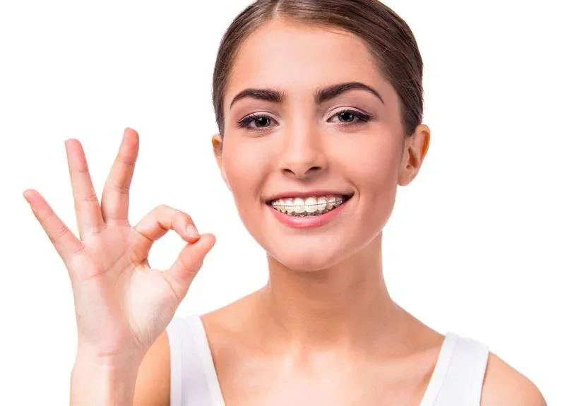 Paciente sonriendo con brackets estéticos