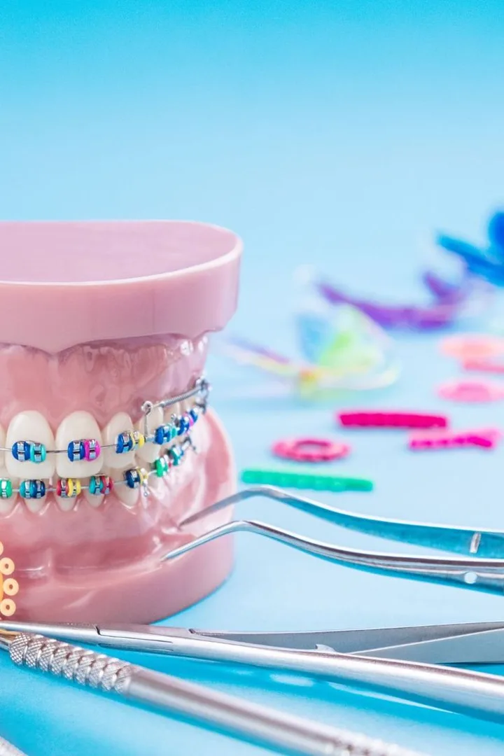 Modelo dental con brackets y herramientas de ortodoncia