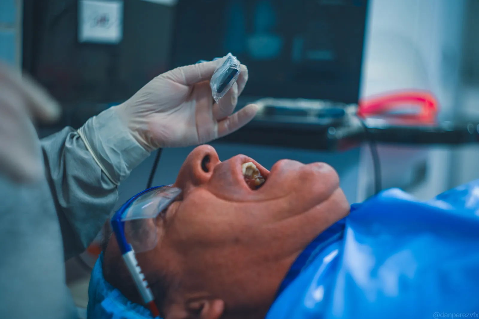 Escaneo intraoral para diseñar una prótesis